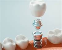 Elke Cheung Dentistry Elke Cheung Dentistry