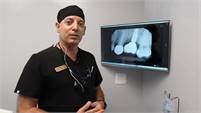  Gardena  Dental Implants